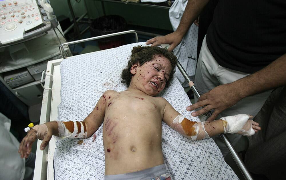 Mohammed Al Awaj, 4, cries while doctors treat him for his injuries following an Israeli airstrike on a vehicle, as he lies on the bed at Nasser hospital in Khan Younis, southern Gaza Strip.