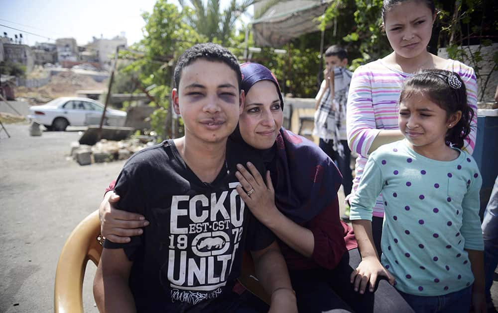 Tariq Abu Khdeir is hugged by his mother Suha after he was released from detention in Jerusalem.