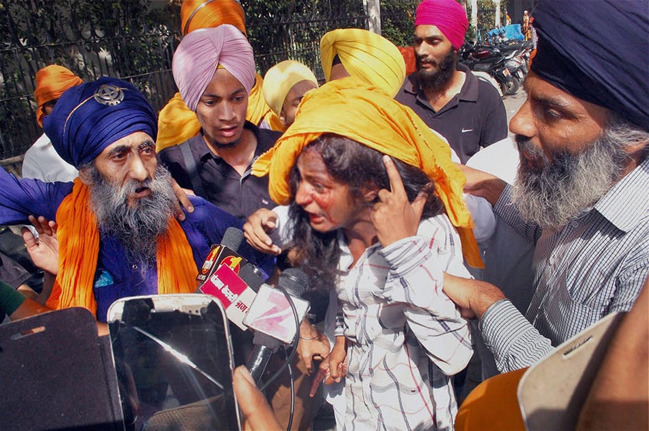 A woman shows her injury to the media after a clash between SGPC and members of a radical Sikh organisation on the 30th anniversary of Operation Bluestar, at Golden Temple Complex in Amritsar.