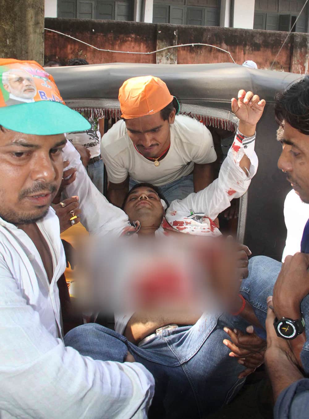 A man injured in bomb blasts is brought for treatment at the government medical college hospital in Patna.