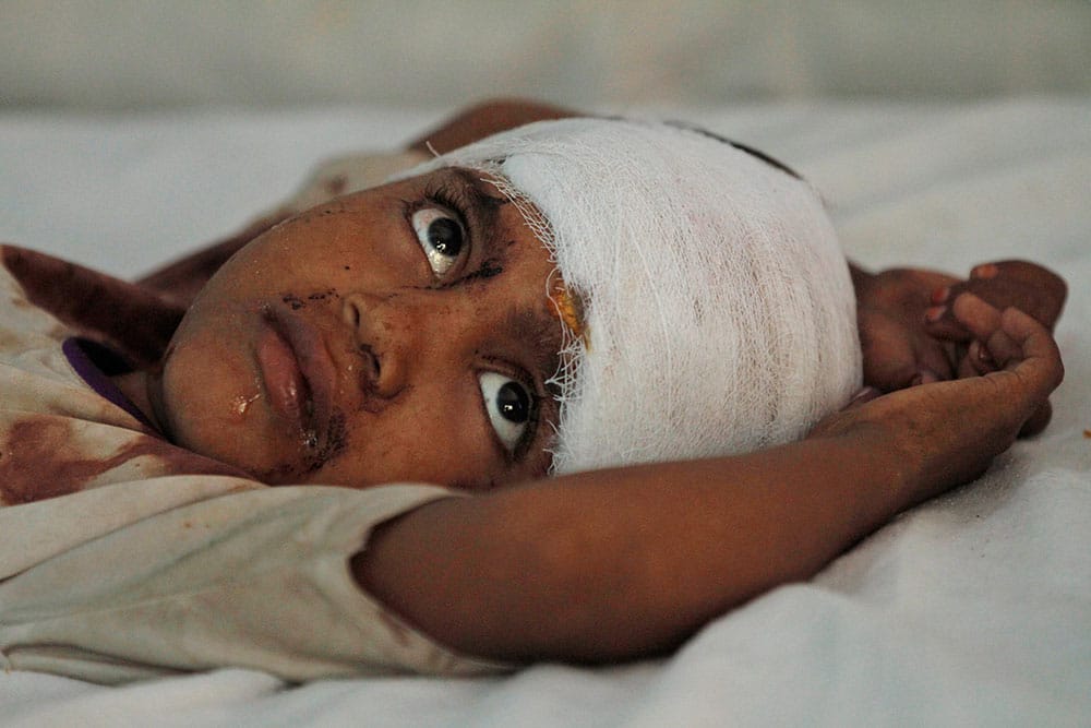 Mehrana, a 6-year-old girl injured in communal clashes, gets treatment at a district hospital in Muzaffarnagar.