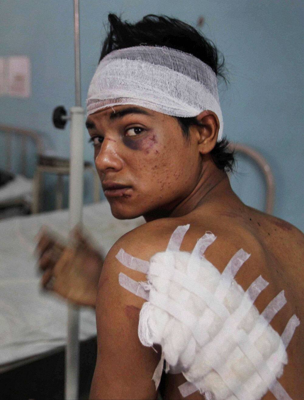 An unidentified youth injured in communal clashes receives treatment at the district hospital at Muzaffarnagar.