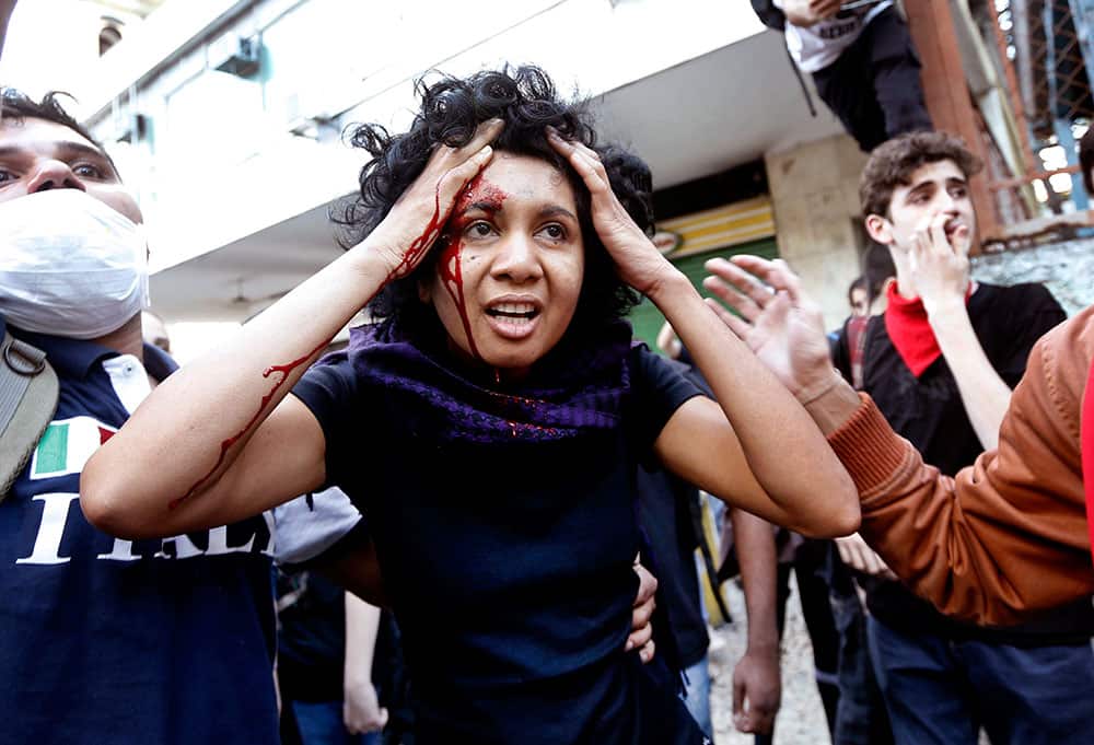 A woman is injured during a protest at a military parade marking Brazil`s Independence Day in Rio de Janeiro, Brazil.