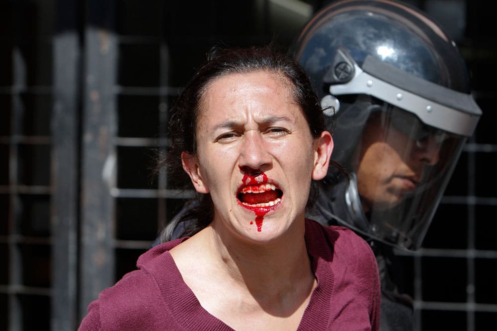 A bleeding protester shouts as she is being taken away by a riot policeman during a march in Mexico City.