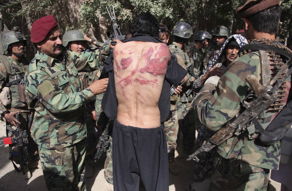 An Afghan commando inspects wounds on the back of a man rescued from alleged Taliban militants during an overnight raid in Herat Province, west of Kabul, Afghanistan.