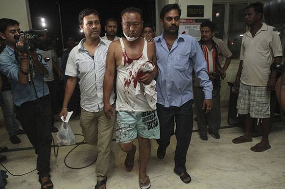 A man injured in a grenade blast is brought to the Medical College hospital in Gauhati. At least 15 people were injured, two of them seriously, in the incident which occurred near a railway station here according to the Press Trust of India.