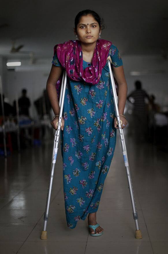Bangladeshi garment worker Sonia, 18, who worked on the 6th floor of Rana Plaza, poses for a portrait at Enam Medical College, in Savar, near Dhaka, Bangladesh.