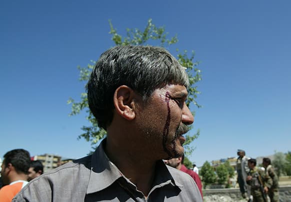 A wounded Afghan man looks on at the site of a blast near the Afghan Independent Human Rights Commission in Kabul, Afghanistan.