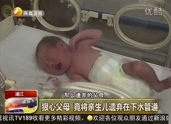 A baby who was rescued after being trapped in a sewage pipe just below a squat toilet in a public building, lies on a bed at a hospital in Jinhua city.