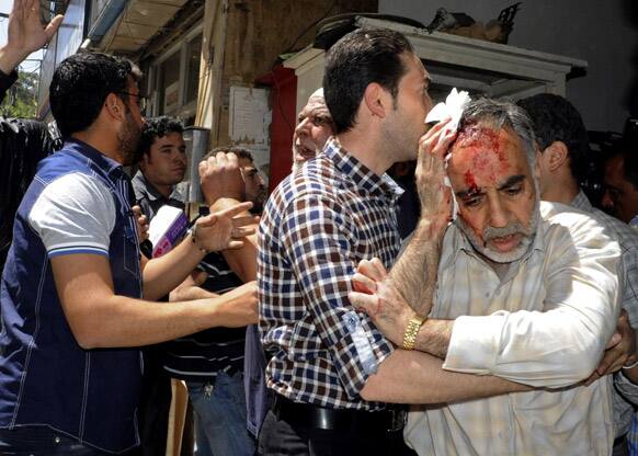 A Syrian man who was injured in a powerful explosion, leaves a damaged building, in the central district of Marjeh, in Damascus, Syria.