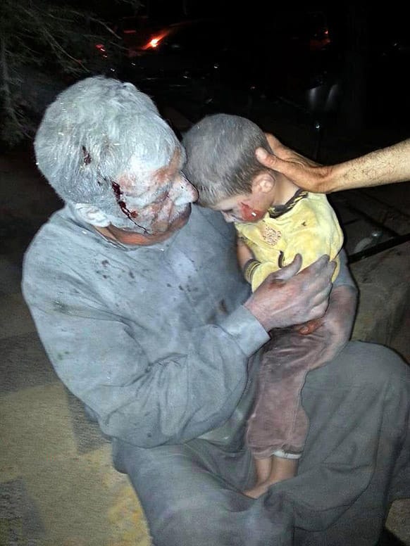A wounded Syrian man holding his injured son after an air raid on the northwestern town of Saraqeb in the province of Idlib, Syria.