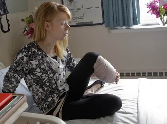Adrianne Haslet, a professional ballroom dancer injured by one of the bombs that exploded near the Boston Marathon finish line, lifts her bandaged left leg in her bed at Spaulding Rehabilitation Hospital in Boston.