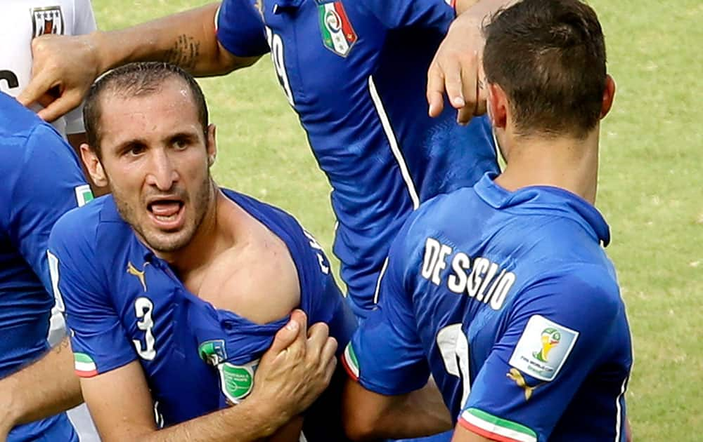 Italy's Giorgio Chiellini displays his shoulder showing apparent teeth marks after colliding with the mouth of Uruguay's Luis Suarez during the group D World Cup soccer match between Italy and Uruguay at the Arena das Dunas in Natal, Brazil.