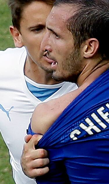 Italy's Giorgio Chiellini shows apparent teeth marks on his shoulder after Uruguay's Luis Suarez ran into his shoulder with his teeth during the group D World Cup soccer match between Italy and Uruguay at the Arena das Dunas in Natal, Brazil.