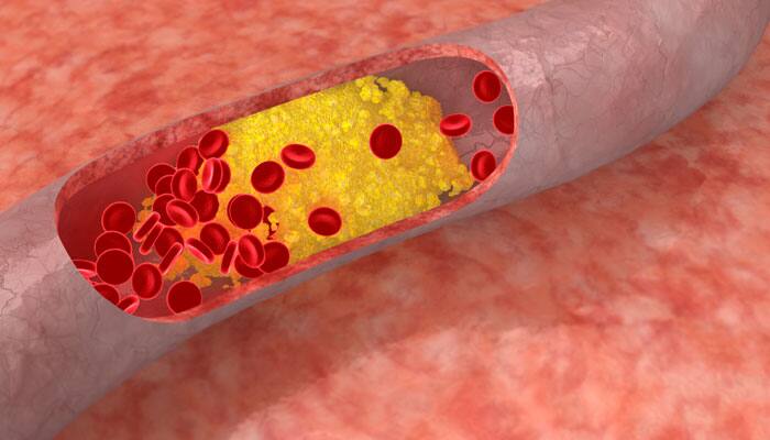 Atomic map reveals how cholesterol is made