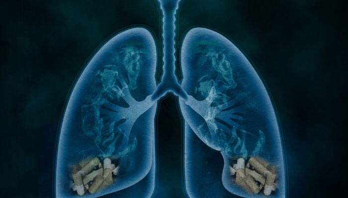 Scientists reveal how 'lung cancer spreads' Health News