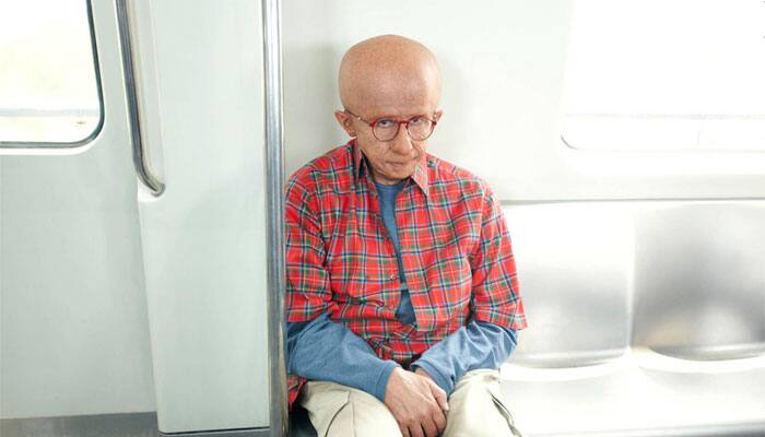 The 2009 movie put the spotlight on a very rare disease called Progeria. The disease is so rare that only 40-50 patients are known to have the condition all over the world. Superstar Amitabh Bachchan played the role of Auro, a 13-year-old-boy suffering with a genetic disorder that leads to quick acceleration of the ageing process. The movie beautifully captured the mental and emotional journey of Auro and the struggle that his parents had to go through.
