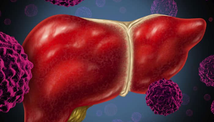 Antioxidant that backs up liver during crisis identified | Health News ...