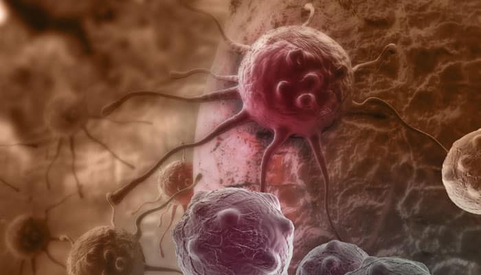 Discarded drug can better fight cancer | Diseases & Conditions News ...