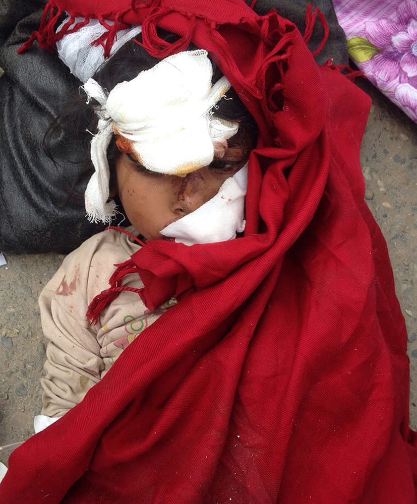 An injured child lies on the ground outside the Medicare Hospital in Kathmandu, Nepal.