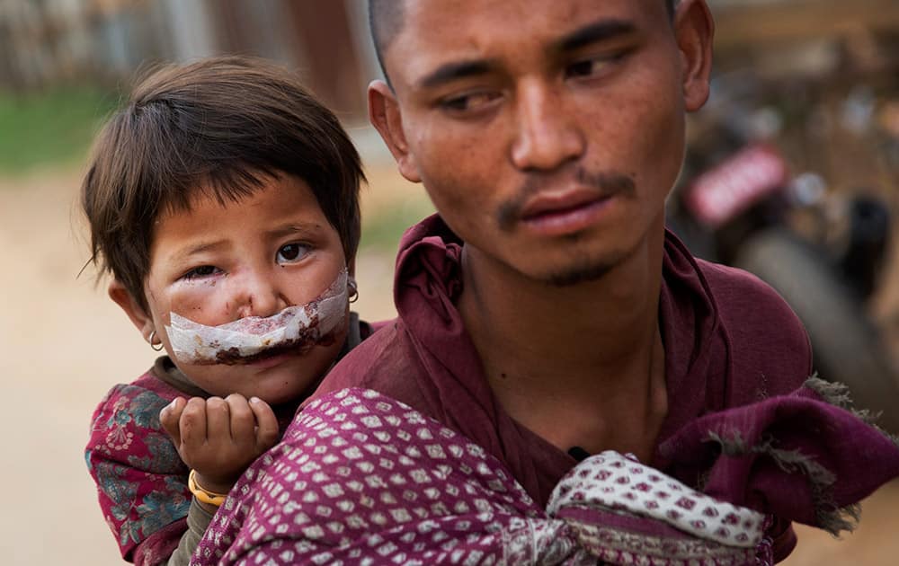 Nepalese child Subha Laxini, 3, who was injured in Tuesday’s earthquake is carried by father Lak Bahadur on their way to a camp for the displaced in Chautara, Nepal.