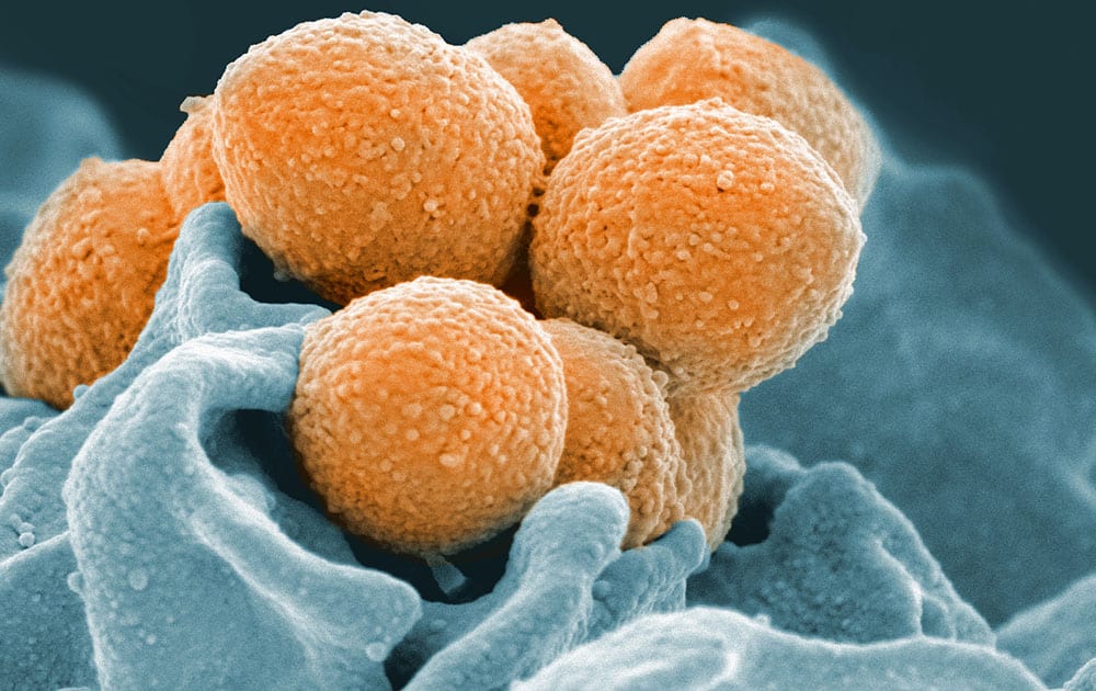 This handout image provided by the National Institute of Allergy and Infectious Diseases shows an electron microscope image of Group A Streptococcus (orange) during phagocytic interaction with a human neutrophil (blue). 