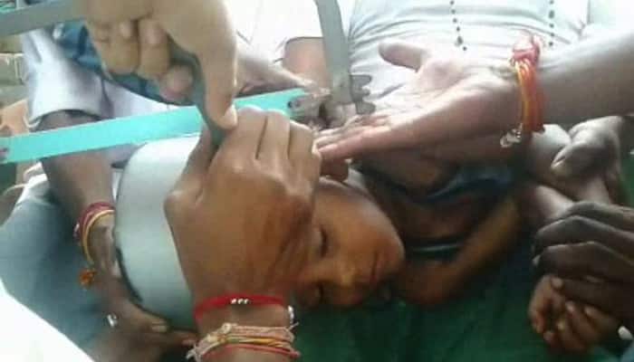 Viral video: 5-year-old child&#039;s head gets stuck in pressure cooker