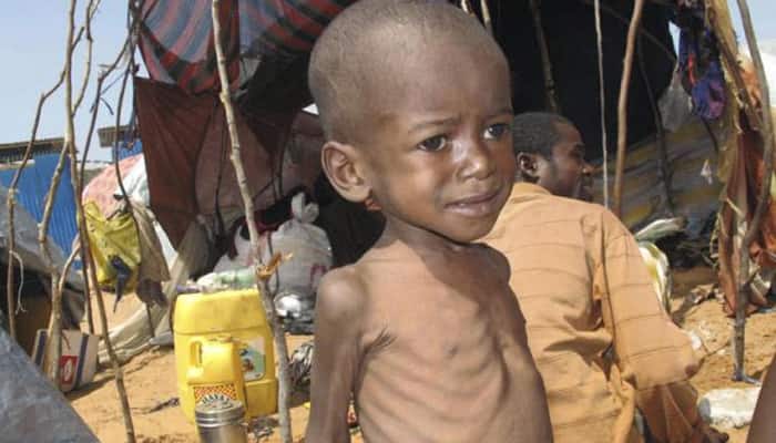 Children starving amid alarming Somalia drought: UN