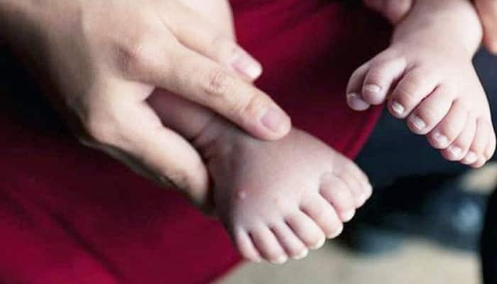 In China, a baby is born with 15 fingers and 16 toes – See pics