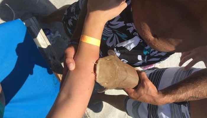 Shocking! Woman bitten by shark taken to hospital with animal still attached to her arm (Pic inside)