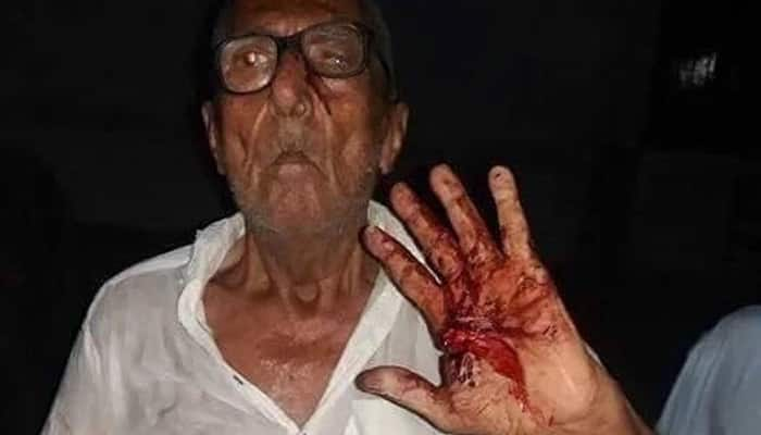 DISTURBING PIC: Hindu man brutally tortured in Pakistan for selling edibles before Iftar