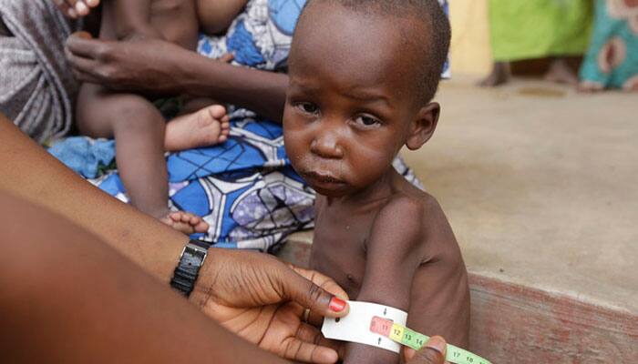 478 children rescued from Boko Haram hospitalised for severe malnutrition