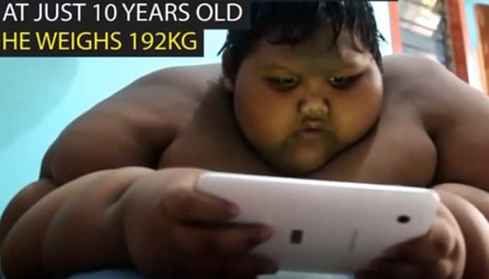 WATCH: OMG! This is unbelievable - Is he the world&#039;s fattest boy? He is just 10 but weighs 192 kgs