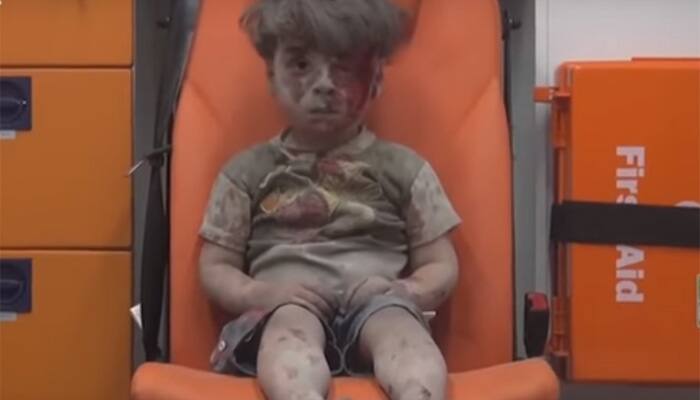 After Aylan Kurdi, picture of this Syrian boy shocks world - Watch heartbreaking video