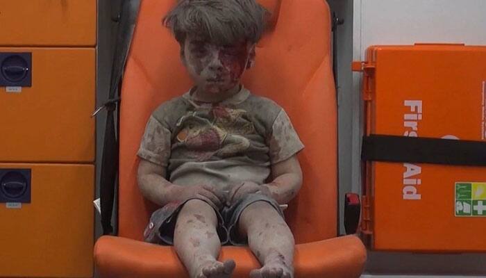 Russia denies its air strikes hit Syrian boy in heart-wrenching photo