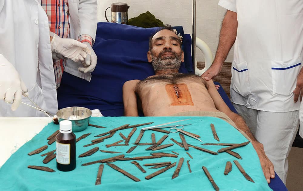 Police constable Surjeet Singh, lies under a table displaying the 40 knifes removed from his stomach recuperates in a hospital in Amritsar