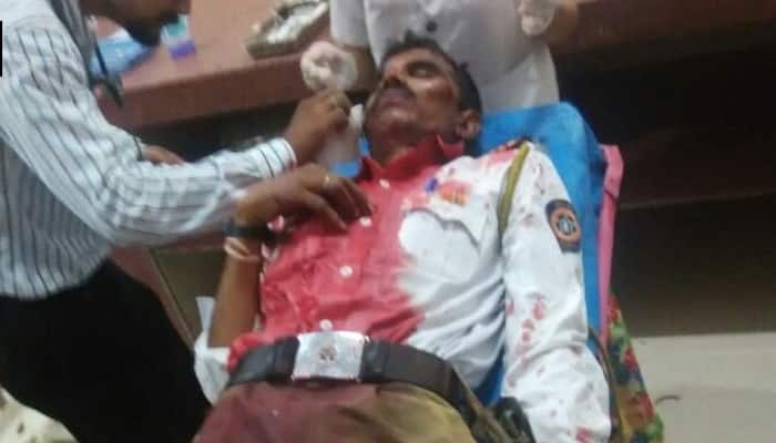 Drunk men stone cop in Maharashtra&#039;s Nagpur, flee after attack