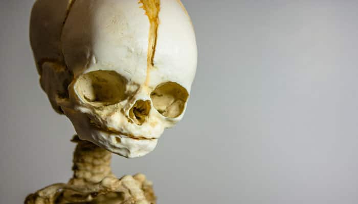2100-year-old human skeleton found on Antikythera Shipwreck