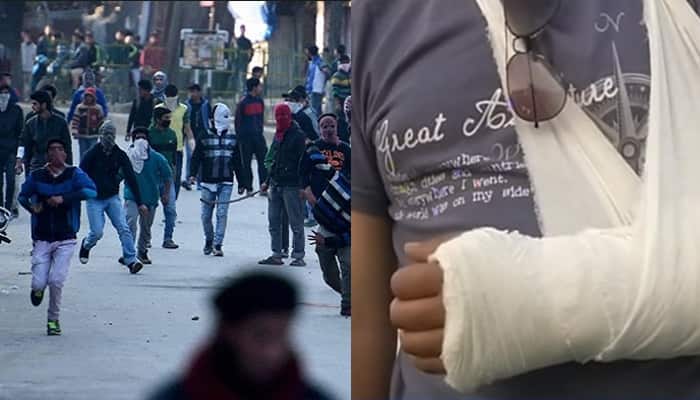 WATCH: Shame on stone pelters! Zee News team attacked near Srinagar; journalist&#039;s hand fractured, car vandalised