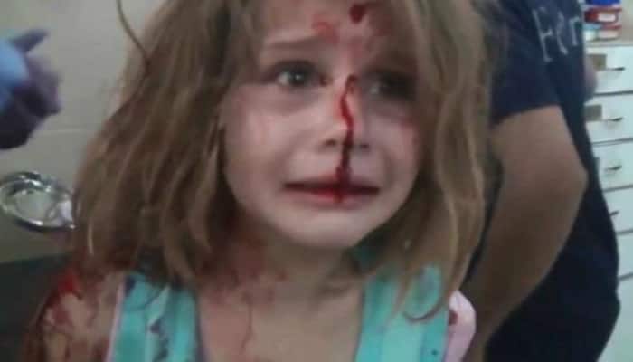 DISTURBING VIDEO of Syrian girl whose heartbreaking tale was mentioned by PM Narendra Modi in Dussehra speech