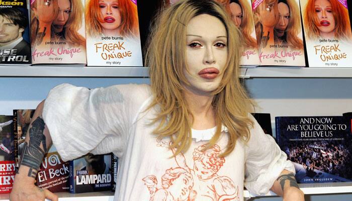 Singer Pete Burns dies of heart attack at 57