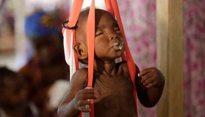 At least 75,000 children in Nigeria risk dying in months: UN