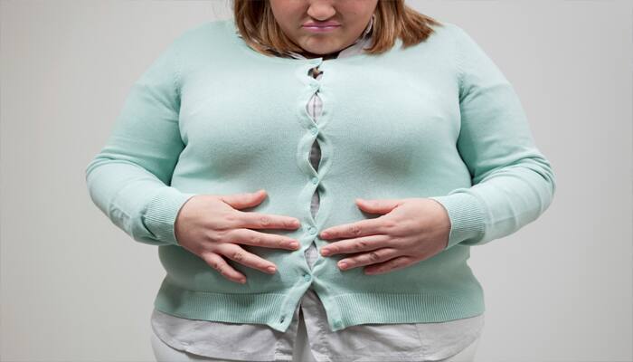 Bariatric surgery may reduce risk of heart failure