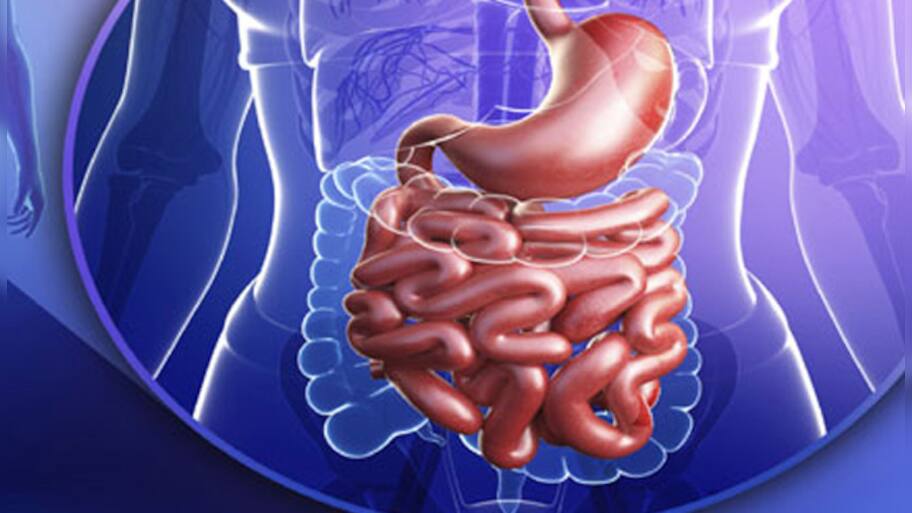 Diverticulitis: Did Fidel Castro die of this disease? What are its ...