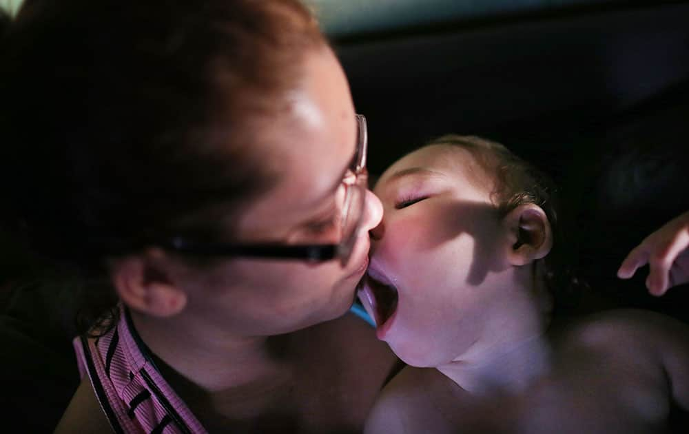 Brazil's Zika Babies