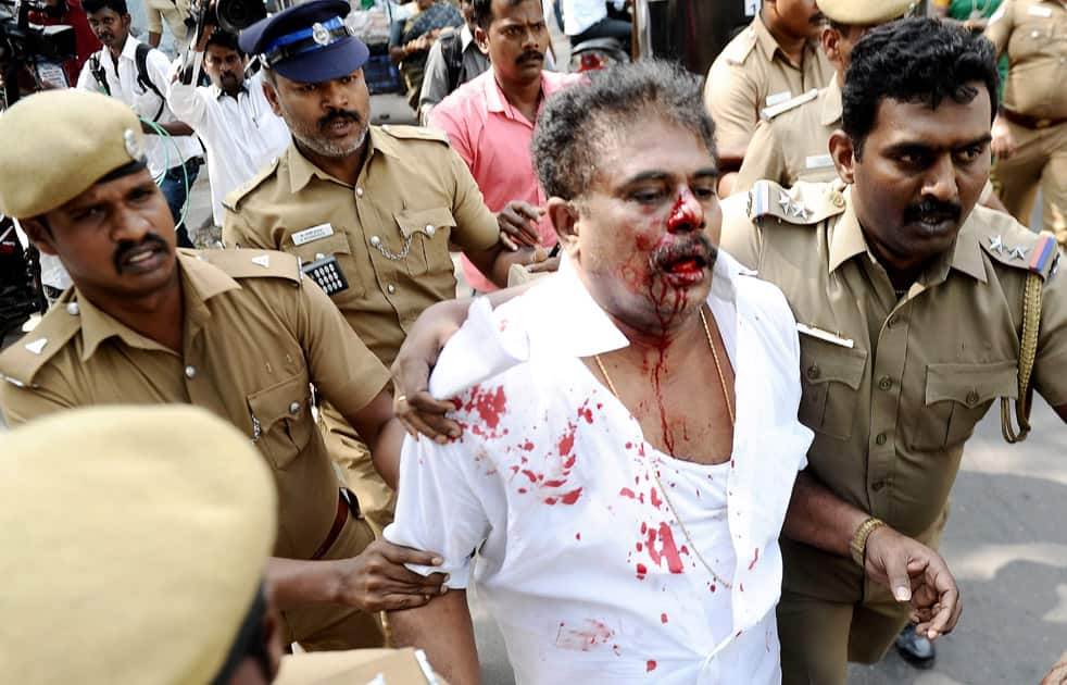 Lingeshwara Thilagan was attacked in Chennai