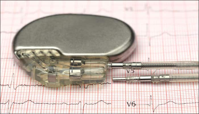 World&#039;s smallest pacemaker makes successful foray into the world inside a bradycardia patient!