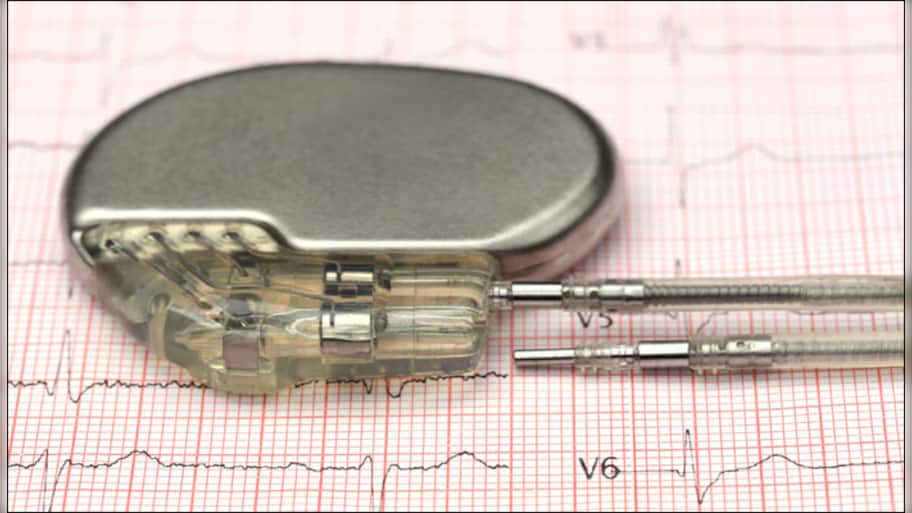 World's smallest pacemaker makes successful foray into the world inside ...