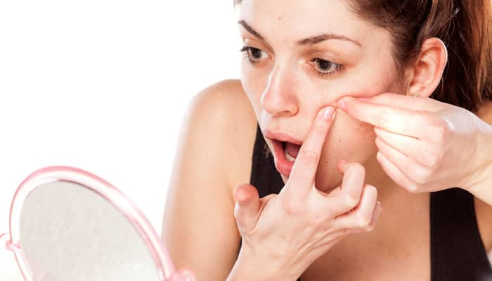 Want to get rid of acne? Stop these habits!