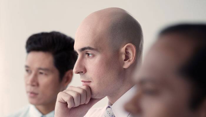 More than 200 baldness-linked genetic markers identified